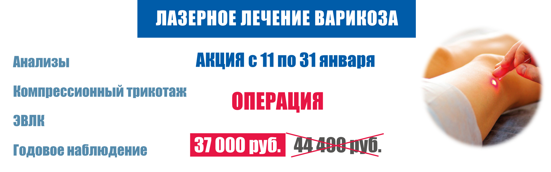 Лазерное лечение варикоза в Самаре за 37 000 рублей Лазерное лечение варикоза в Самаре за 37 000 рублей